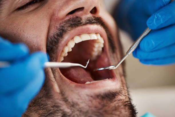 Fast & Reliable Emergency Dental Services in TX